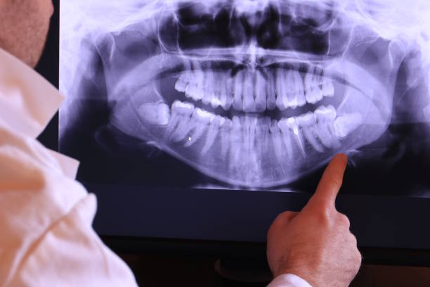 Best Emergency Dental Surgery in Roseville, MI