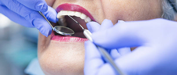 Best Emergency Tooth Extraction in Roseville, MI